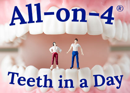 Des Moines dentist, Dr. Chad Johnson at Veranda Dentistry explains how All-on-4® can improve your life with same-day implant-supported dental restorations.