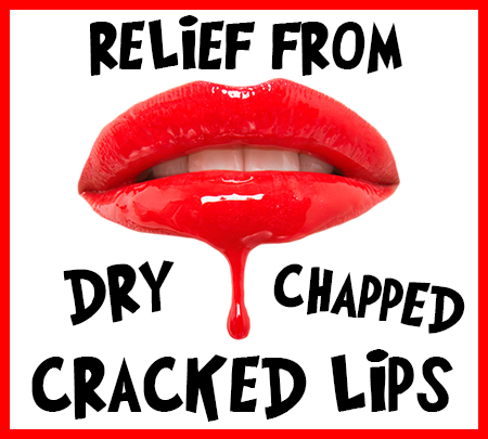 Des Moines dentists at Veranda Dentistry, tells you how to relieve your dry, chapped, and cracked lips!