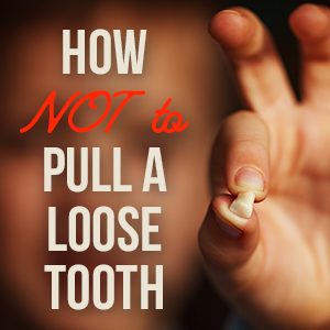 Pleasant Hill dentist, Dr. Johnson at Veranda Dentistry, tells parents the do’s and don’ts of pulling your child’s loose baby teeth for the safest and most painless experience.
