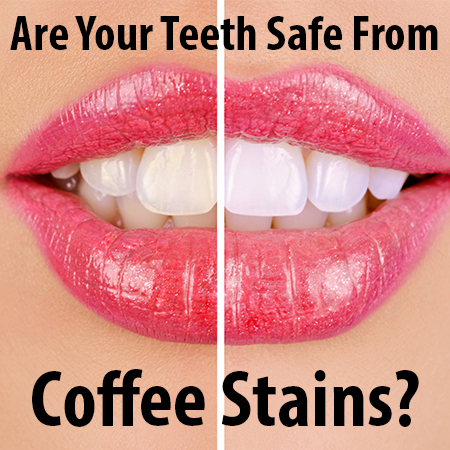 You don’t have to put up with discoloration and coffee stained teeth. Veranda Dentistry, tells you about teeth whitening in Des Moines.
