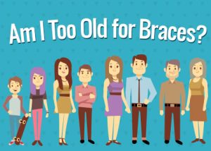 Des Moines dentist, Dr. Chad Johnson of Veranda Dentistry discusses braces and what age, if any, is too late to straighten teeth.