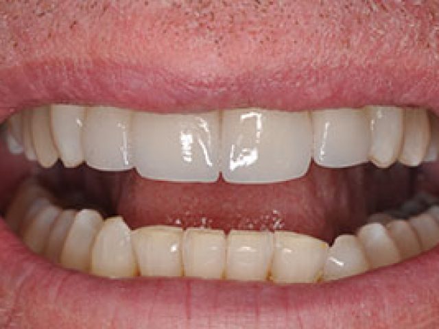 Comprehensive Oral Healthcare Includes Cosmetic Dentistry (featured image)