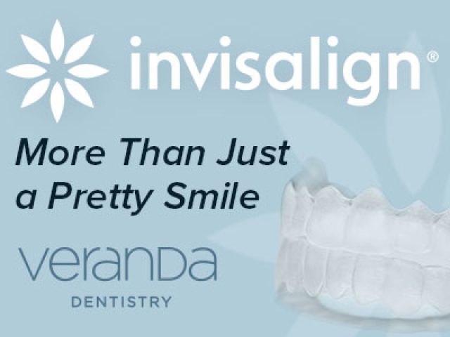 Invisalign® Case Study: More than Just a Pretty Smile (featured image)